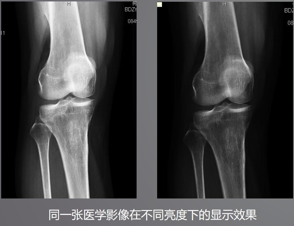 寵物DR設(shè)備的顯示器有要求？普通和醫(yī)用顯示器有什么區(qū)別