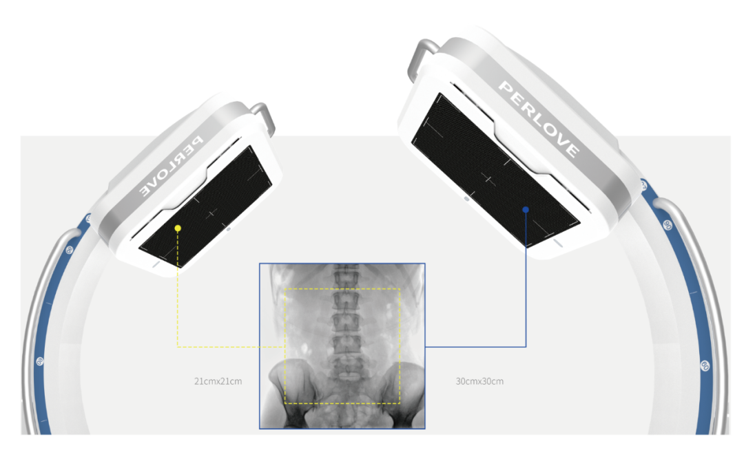 大平板一體式C形臂大視野