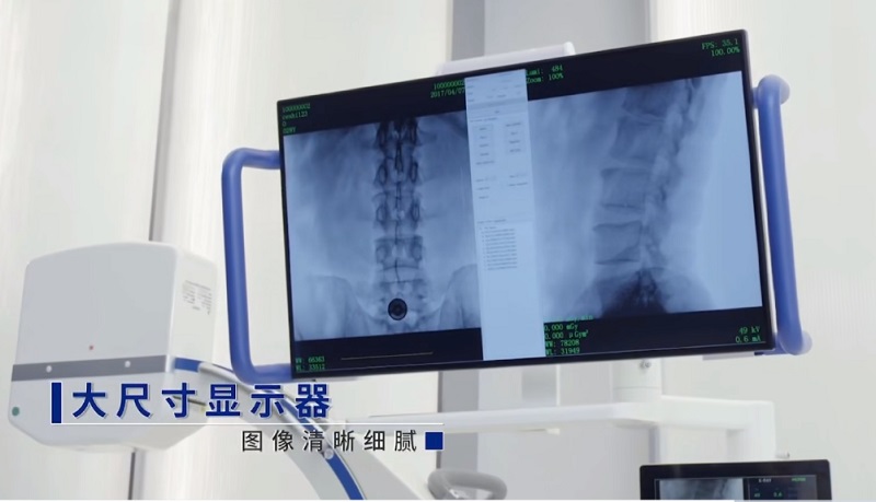 c臂機輻射范圍是多少 手術室的c臂機輻射大嗎